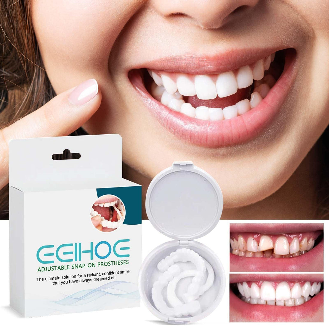 EELHOE Adjustable Buckle Dentures, Modified Teeth Interdental Set Orthodontic Dentures Set - Awesome Marketplace